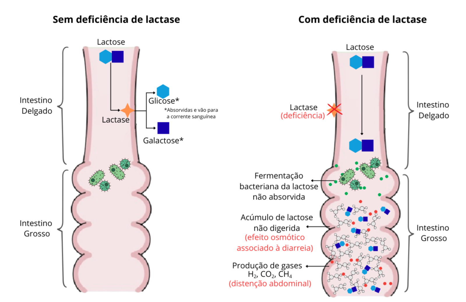 Intolerância à lactose e derivados lácteos: A ciência do queijo ...